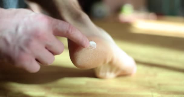 Man Applying Moisturizing Lotion Problem Areas Skin Leg Heel Barefoot — Stock Video