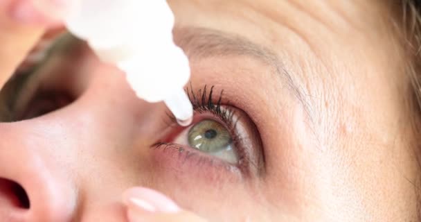 Gotas Garrafa Estão Pingando Mulher Olho Seco Closeup Conceito Tratamento — Vídeo de Stock