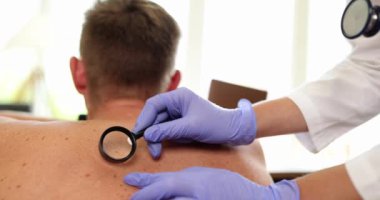 Doktor dermatolog, büyüteçle büyüteç ve ağır çekimde pigmentli nevi üzerinde çalışıyor. Nevus kavramının kötü huyluluğunun belirtileri