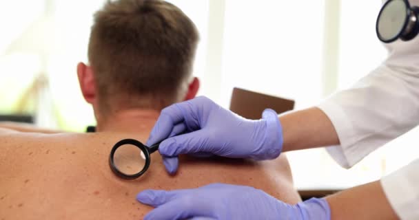 Dermatólogo Médico Examinando Nevos Pigmentados Espalda Del Paciente Con Lupa — Vídeo de stock