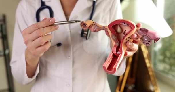 妇科医生在人类子宫和卵巢模型上显示输卵管 近距离观察4K片慢动作 女性生殖系统概念问题 — 图库视频影像