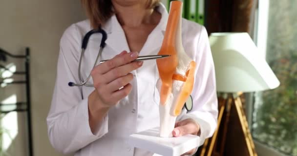 Médico Mostrando Ligamentos Músculos Modelo Artificial Articulação Joelho Humano Closeup — Vídeo de Stock