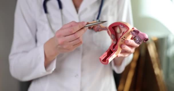 妇科医生展示了一个具有病理学特写的子宫和卵巢解剖模型 妇科疾病和治疗 — 图库视频影像