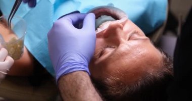 Dentist takes out cotton swab after dental treatment. Dental treatment in dental clinic