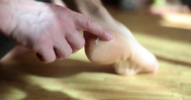 Man Hand Applies Moisturizing Nourishing Cream Heels Feet Dry Cracked — Wideo stockowe