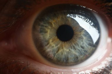 Women wide open gray green pupil closeup. Astigmatism farsightedness myopia and laser vision correction