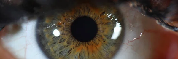 Detail of human eye with gray green iris. Eye diseases and laser vision correction concept