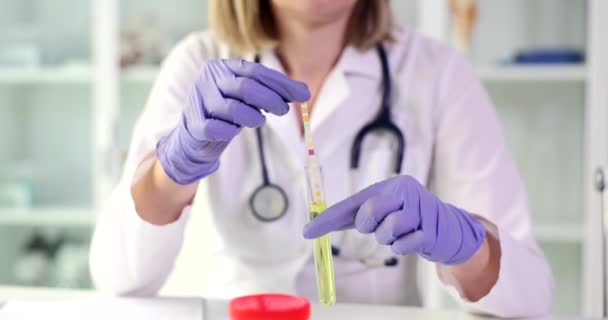 Doctor Urologist Lowering Test Strip Tube Express Urine Analysis Closeup — Stockvideo