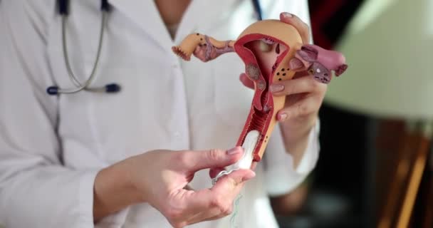 Gynecologist Showing How Insert Hygienic Tampon Vagina Artificial Model Uterus — стоковое видео