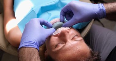 Dentist tries on dental sample for installing veneer. Preparation of teeth for veneers
