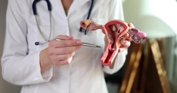 Doctor Gynecologist Demonstrates Model Female Reproductive System Gynecological Care Uterus — Stok video