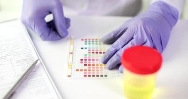 Ürolog doktor idrar analizini yakın plan gösterge kağıdı kullanarak yapıyor. İdrar tahlili ve test şeritlerinin teşhis değeri