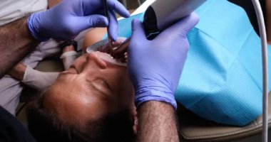 Diş hekimi seramik kaplama ve kaplama takmadan önce hasta için intraoral tarama yapıyor. Ortodontist el bilgisayarı 3B çene ve ağız tarayıcısını elinde tutuyor