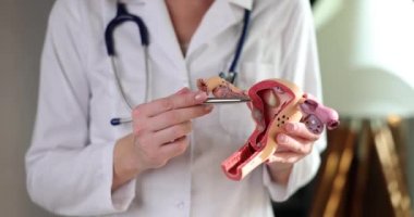 Gynecologist shows anatomical model of uterus and ovaries with pathologies. Doctor diseases and infertility treatment