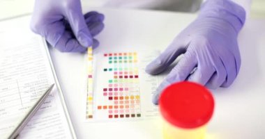 Doktor laboratuarda hızlı idrar testi yapıyor. Renk testi şeridine göre idrar analizi