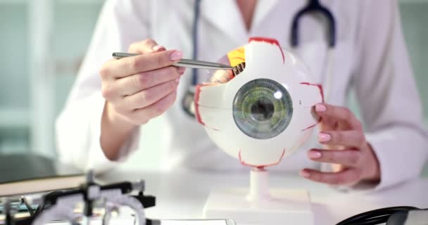 Okulista Posiada Anatomiczny Model Ludzkiego Oka Diagnoza Chorób Oczu — Wideo stockowe