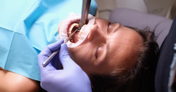 Dentist Doctor Illuminates Filling Modern Lamp Closeup Clinic Preparing Teeth — Stockvideo