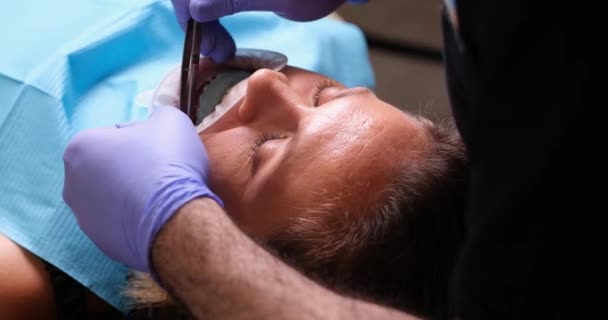Οδοντίατρος Προετοιμάζει Γυναικεία Δόντια Για Την Εγκατάσταση Κεραμικών Καπλαμάδων Και — Αρχείο Βίντεο
