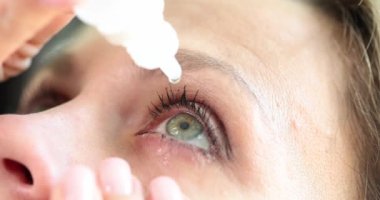 Close-up face woman is dripping medicine in the eye, slowmotion. Eye drops, vision problems, therapy
