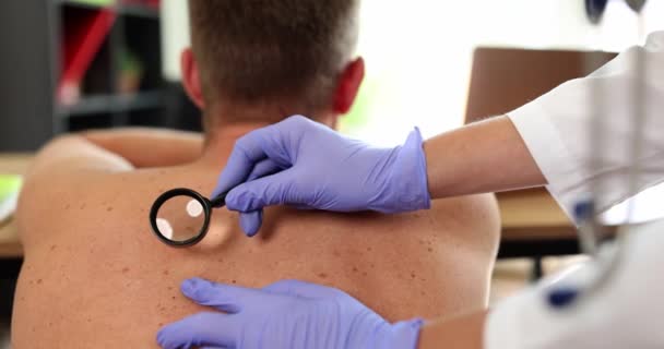 Dermatolog Bada Pieprzyk Plecach Szkłem Powiększającym Zbliżenie Spowolnienie Choroby Skóry — Wideo stockowe