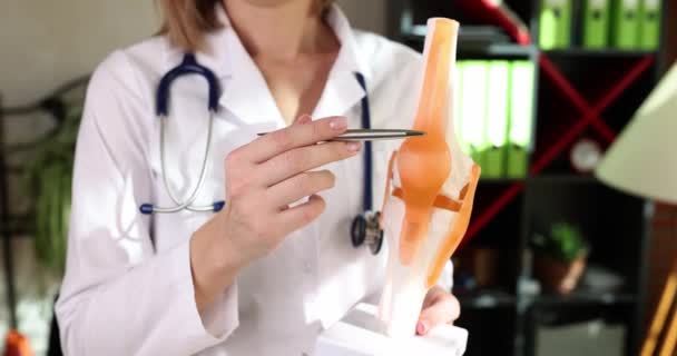 医者は人間の膝の解剖学的モデル クローズアップを示しています 筋骨格系の治療 — ストック動画