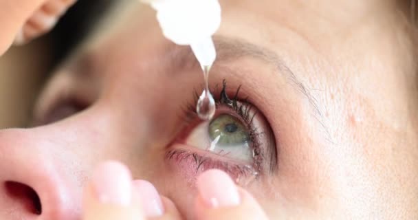 Ιατρική Της Όρασης Και Οφθαλμολογία Γυναίκα Που Βάζει Οφθαλμικές Σταγόνες — Αρχείο Βίντεο