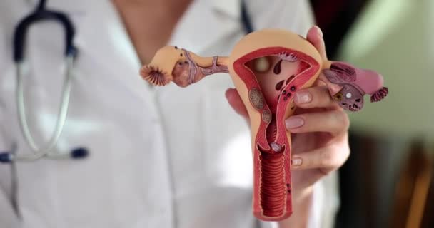 Gynecologist Holds Anatomy Uterus Thumbs Recommendations Quality Gynecological Examination — Vídeo de Stock