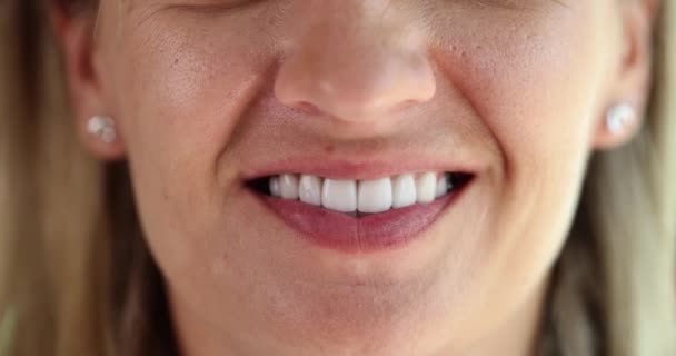 Όμορφο Χαμόγελο Υγιή Λεία Λευκά Δόντια Προσόψεις Closeup Έννοια Της — Αρχείο Βίντεο
