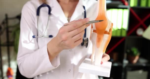 Doctor Shows Anatomy Structure Human Knee Joint Clinic Arthrosis Knee — Video Stock