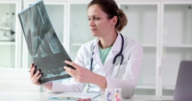 Female doctor examines x-ray of a patient spine during visit. Traumatologist orthopedist and spinal injuries
