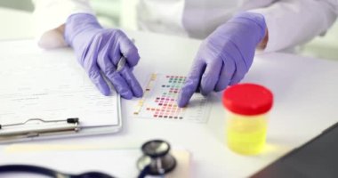 Kadın laboratuvarda PH materyaliyle idrar testi yapıyor. Eldivenli doktor renkli cilalı ve idrarlı.