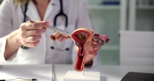 Ginekolog Pokazuje Anatomiczny Model Macicy Jajników Ciąża Niepłodność Kobiet Systemie — Wideo stockowe