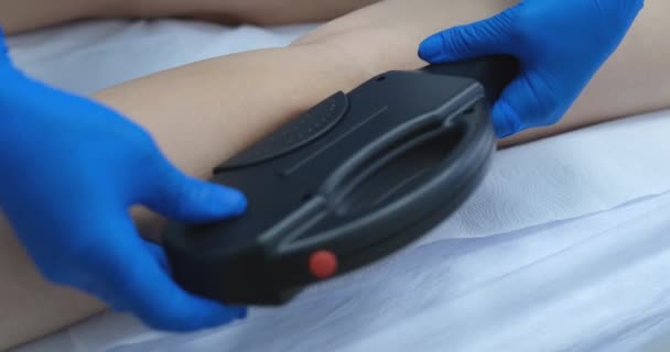 Kosmetička Odstraňuje Chlupy Ženských Nohou Laserové Odstranění Ochlupení Salonu Krásy — Stock video