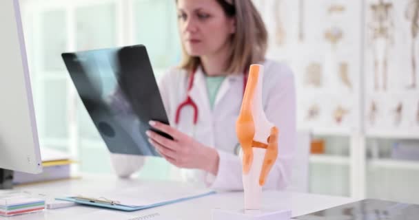 Traumatologist Examines Ray Image Person Knee Joint Closeup Traumatic Injury — Stock video