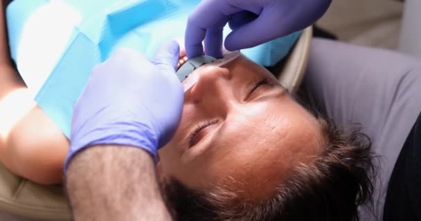 Diş Hekimi Diş Implantasyonundan Önce Hasta Dişlerinin Kalıbını Çıkarmaya Çalışıyor — Stok video