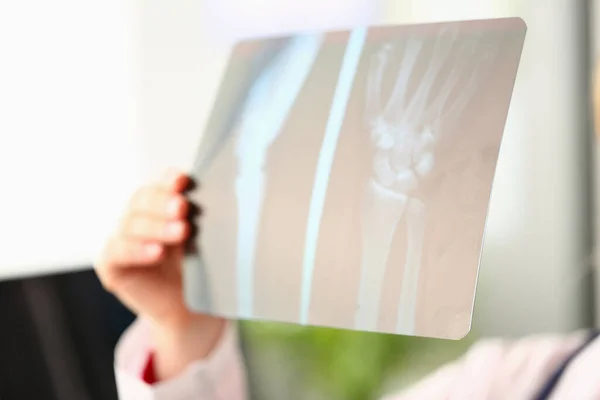 Dokter Houdt Röntgenfoto Van Arm Handen Medische Hulp Tijdens Het — Stockfoto