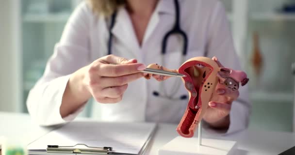 Struktur Organ Genital Perempuan Dan Libido Pencalonan Vagina Menyebabkan Diagnosis — Stok Video