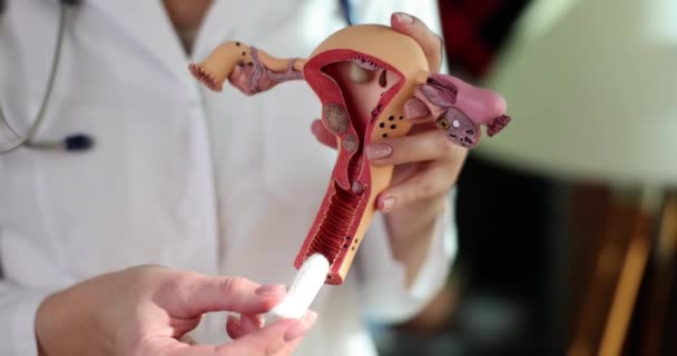 Vrouw Gezondheid Menstruatie Voortplantingssysteem Met Tampons Hygiënische Tampons Advies Van — Stockvideo