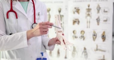 Ortopedik doktor ayak bileğindeki iskelete bakıyor. Doktor klinikteki ayak bileği eklemlerinin bozulma nedenlerini analiz etti.