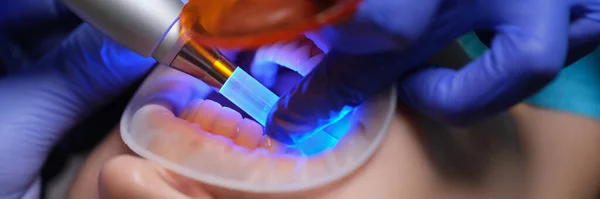 Médico Dentista Iluminando Enchimento Com Lâmpada Luz Moderna Closeup Clínica — Fotografia de Stock