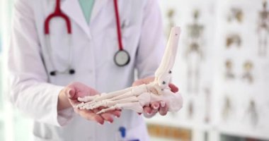 Travmatolog ortopedist insan bacağının iskeletini gösterdi. Ayak ve parmak eklemlerinde artrosis.