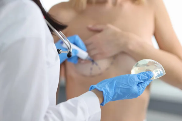 Läkaren Ritar Märken Kvinnliga Bröst Kosmetisk Operation Silikonimplantat Och Bröstlyft — Stockfoto