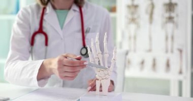 Doktor romatolog insan elinin yapısını anatomik model yakın çekim 4K yavaş çekim filminde gösteriyor. Kol romatizma hastalığı konsepti patolojisi