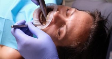 Dişçi seramik kaplama ve kaplama takmadan önce bir kadın için intraoral tarama yapar. Protez ve kaplama kurulumu