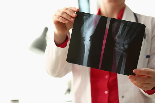 Orthopeed Onderzoekt Röntgenfoto Van Patiënt Hand Kliniek Artritis Van Vingers — Stockfoto