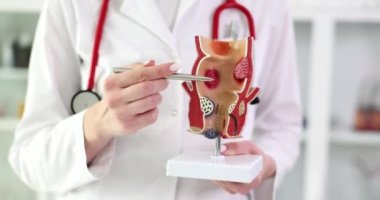 Tıp bilimi profesörü, rektum hastalıklarını insan organının yapay yakın çekim 4K filminde yavaş çekim modelinde gösteriyor. Rektum konsepti tümörlerinin proktoloji teşhisi ve tedavisi
