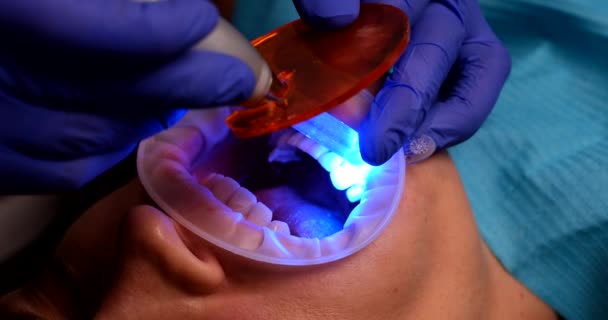 Dentista Médico Ilumina Relleno Diente Del Paciente Usando Máquina Llevada — Vídeo de stock
