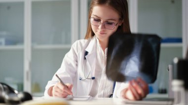Ellerinde ciğerlerinin röntgenini tutan ve klinikteki tıbbi belgelere yazan terapist doktor. Zatürree ve akciğer kanseri teşhisi ve tedavisi