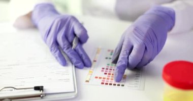 İdrar testleri klinikteki idrar testleri. Eldivenli eller turnusol bantlarıyla test yapıyor.