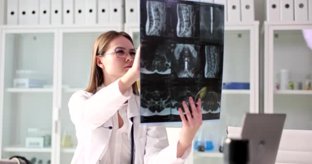 医師は診療所で患者の脊椎のX線を見て分析します 診療所でX線を検査する女性外傷科医 — ストック動画